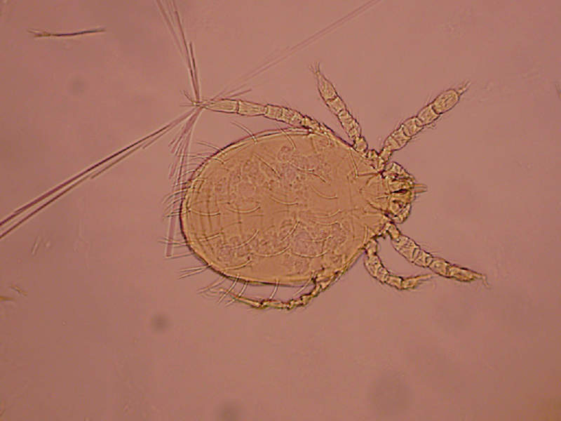 Chigger Mites